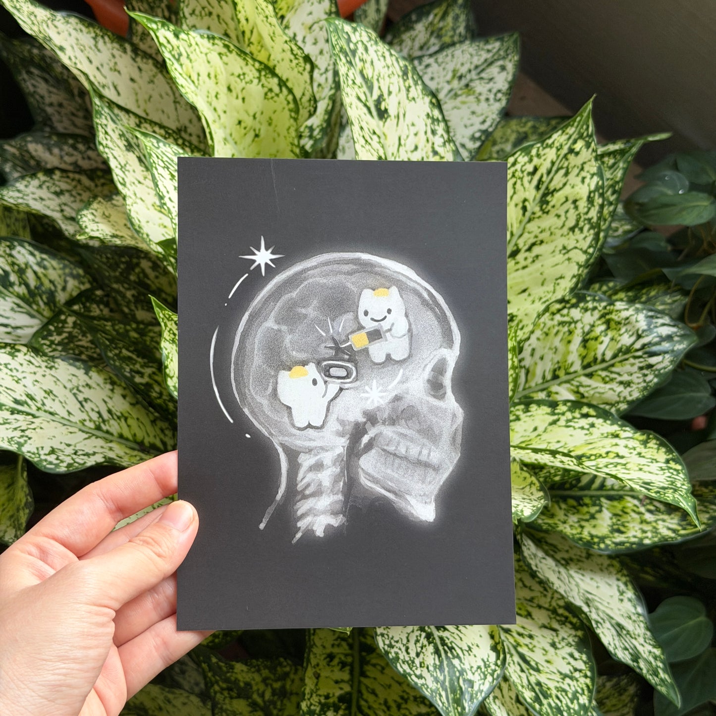 xray prints