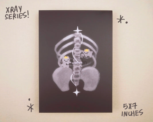 xray prints