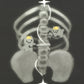 xray prints
