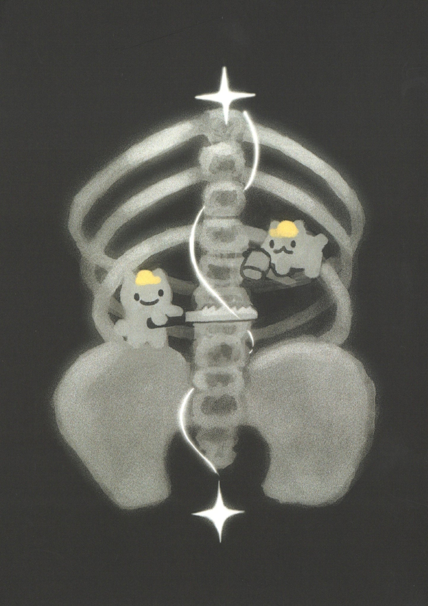 xray prints