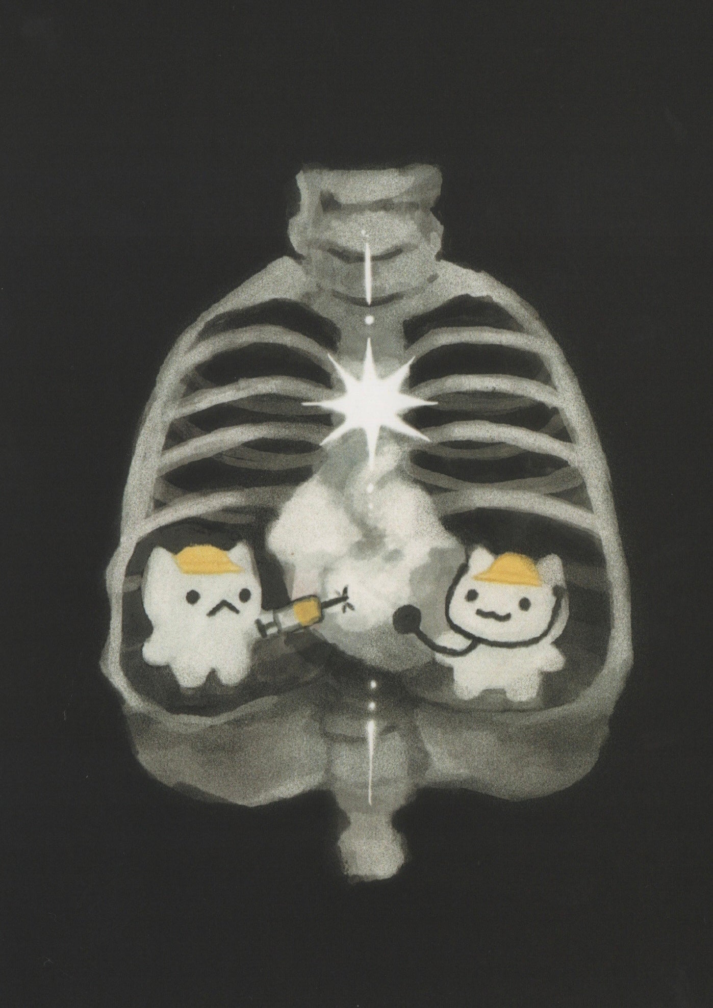 xray prints