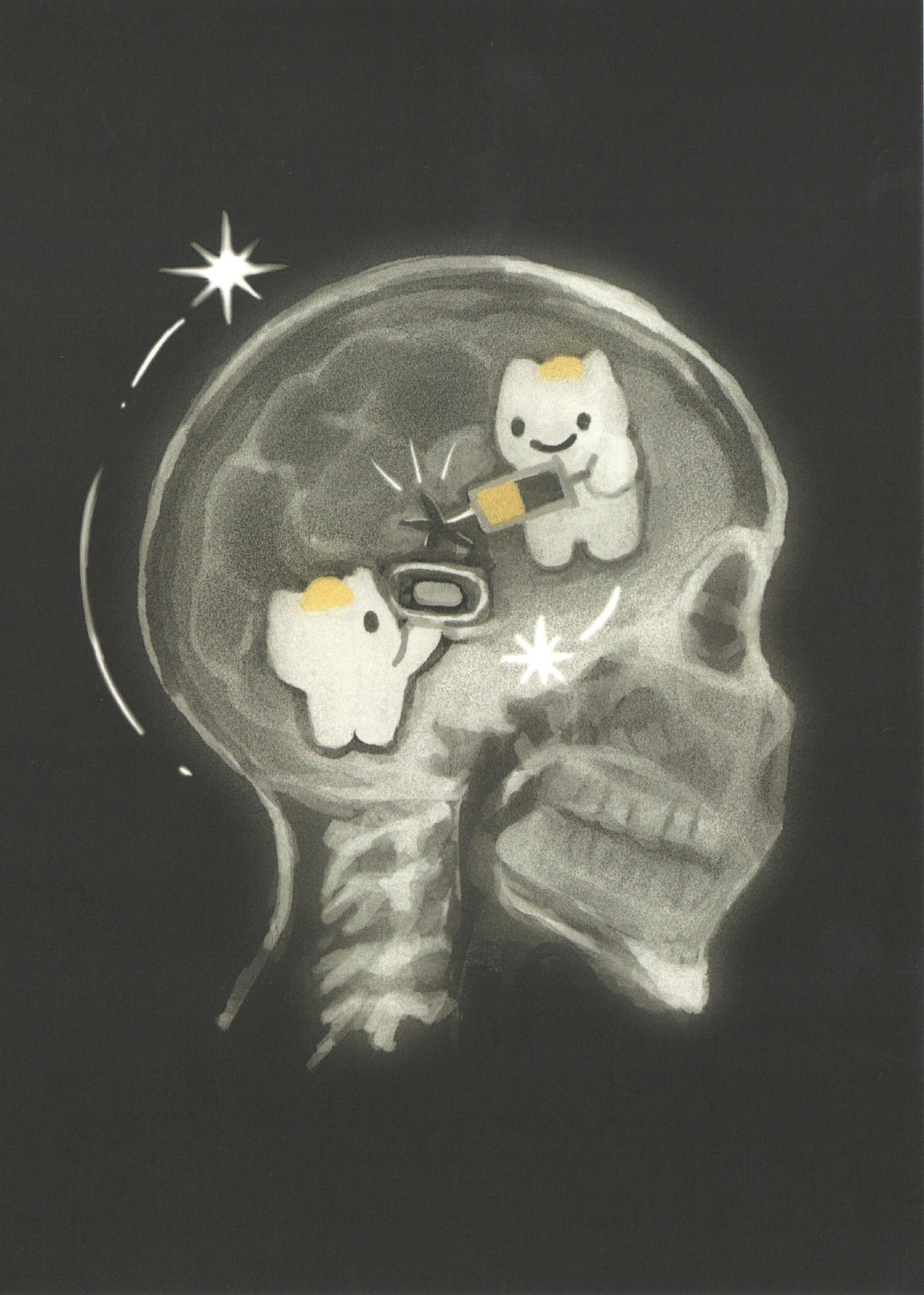 xray prints