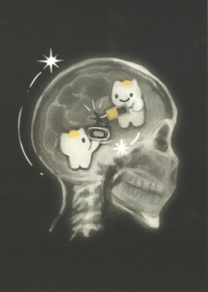 xray prints