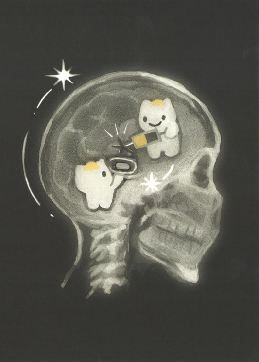 xray prints
