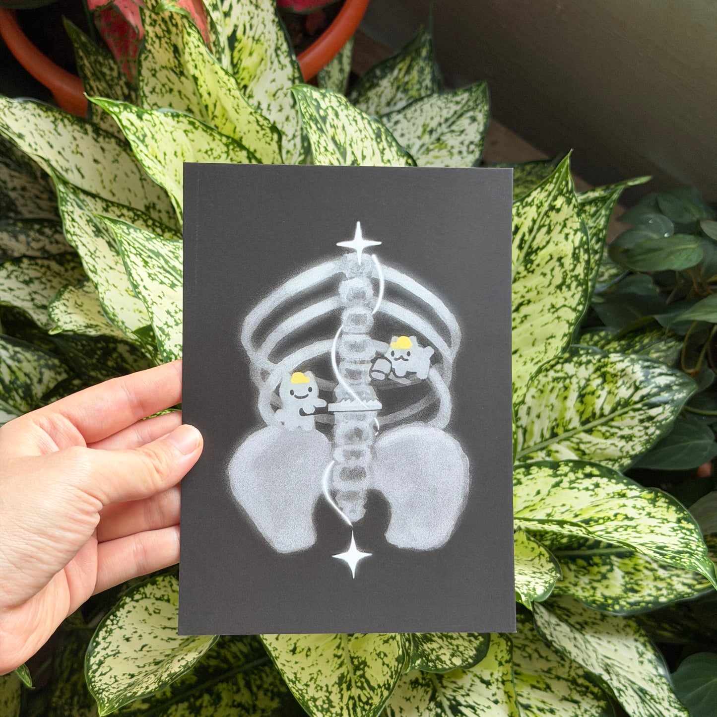 xray prints