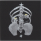 backache sticker